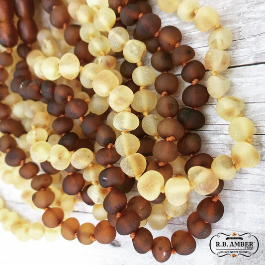 Raw Cognac Baltic Amber Necklace: 12-13 inches